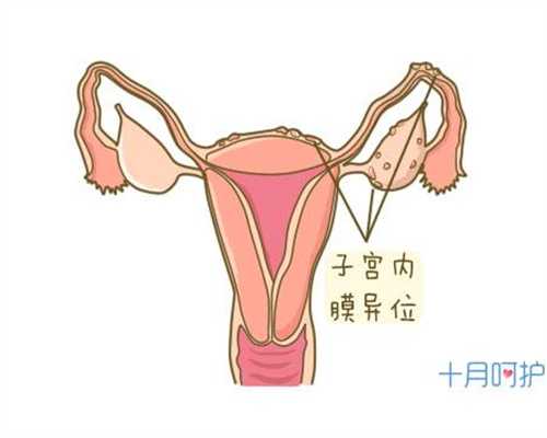 代孕孕吐怎么办 缓解孕吐最有效的六个方法_扬州
