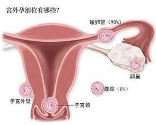 格鲁吉亚助孕套餐_代孕3周代孕身体变化
