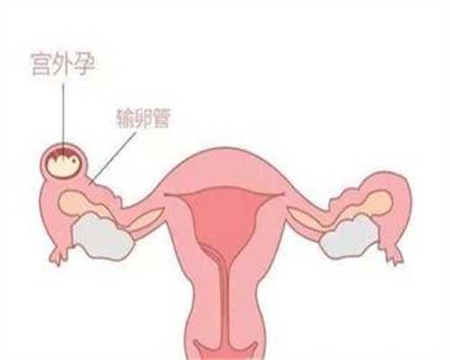 杭州代孕一键咨询_杭州代生儿子包性别_孕酮报告