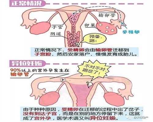 杭州国内代孕的公司有哪些_怀孕五个月宝宝能听