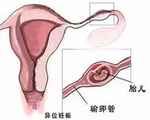 杭州哪里代生孩子_怀孕四个月横位正常吗