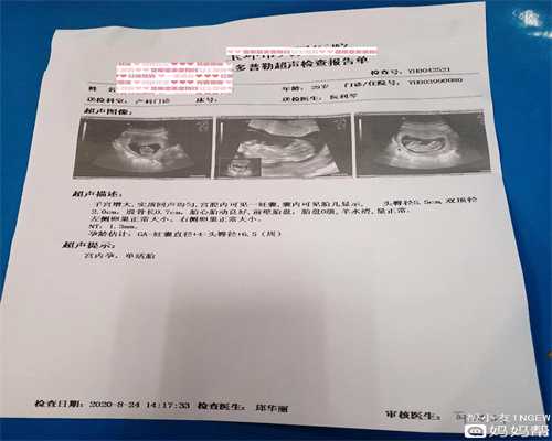金贝供卵医院合法吗_口碑好供卵试管机构_上海做试管婴儿去美国的生活预算费