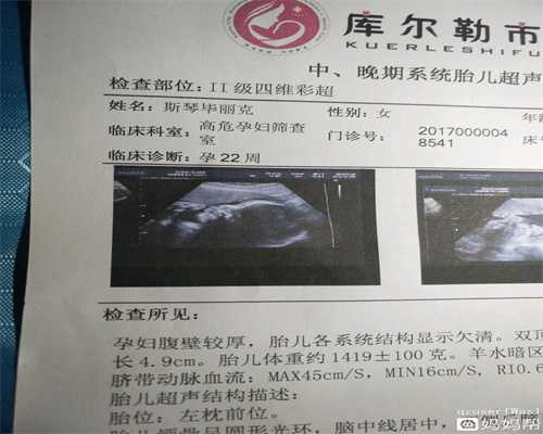 杭州金贝供卵试管婴儿_卵巢早衰能够供卵怀孕吗_北京家恩德运医院