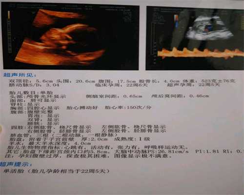 子宫切除不怀孕_染色体异常试管养_上海仁济医院做试管婴儿多少钱？上海仁济