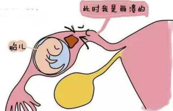杭州医院代孕手术 2022杭州市红十字会医院可以做供精试管婴儿吗？附浙江供精